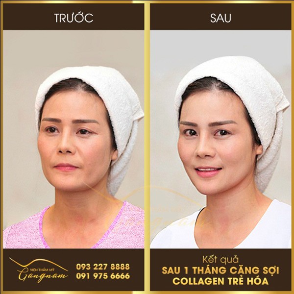 that hu ve cong nghe tre dep vuot thoi gian - 1